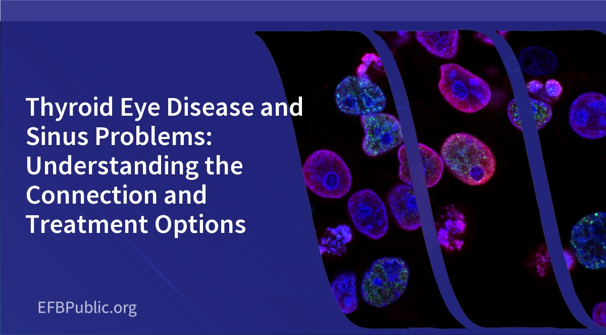 Thyroid Eye Disease and Sinus Problems: Understanding the Connection and Treatment Options